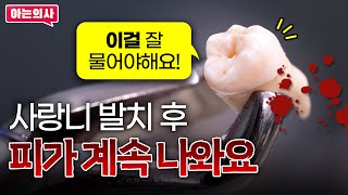 #사랑니발치 후 피가 계속 나와요, 출혈이 안멎는 이유