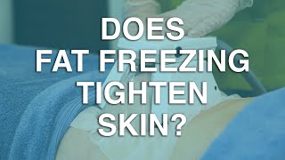 Does fat freezing tighten skin? | The Body Clinic | Fat Freezing FAQ ❄️