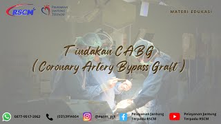 Tindakan CABG (Coronary Artery Bypass Graft)