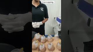 Cryo cupping therapy At Best Physiotherapy Clinic Galena Physiotherapy and sports performance centre