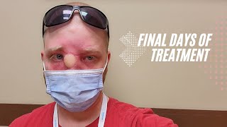 My Treatment Is Ending..+ Cancer Update