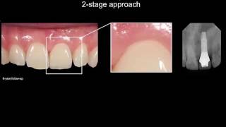 Module 3  Clinical protocols and treatment considerations - part 4