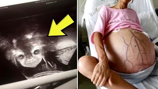 Woman with Huge Baby Bump Visits Doctor but Claims She's Not Pregnant