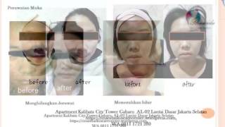 0811 1721 280, Klinik kecantikan para artis di Jakarta Selatan Rinanda  Skin Care Center