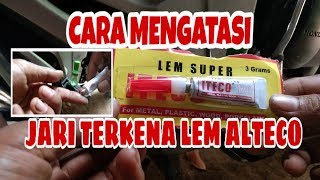 Cara Mengatasi Jari Terkena Lem Alteco atau Lem Korea