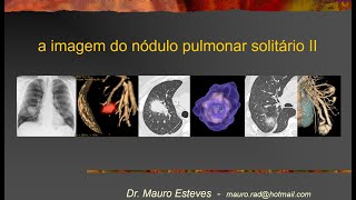 Nódulo pulmonar II