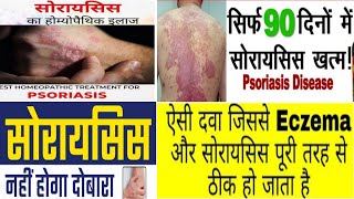 Best Medicine For Psoriasis/Indo German Ki  Psoria Care Drop/Sabsey Effective Medicine For Psoriasis