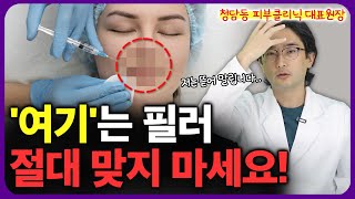 청담동 클리닉 원장이 절대 추천하지 않는 필러 부위 3곳