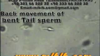 Bent Tail sperm ,back movementssperm video