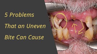 5 Problems and Uneven Bite can Cause