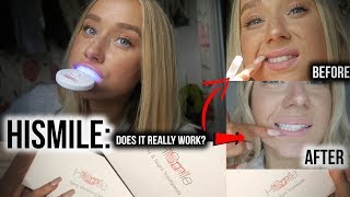 Hi Smile Teeth Whitening: REVIEW!! | Before & After... does it work? (day by day results)