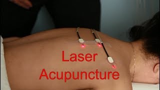 Laser Acupuncture