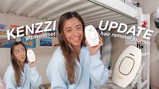 KENZZI IPL HANDSET: 6 month update, my hair removal journey, personal results! *w/ discount code!*