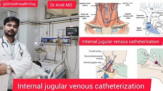 INTERNAL JUGULAR VENOUS CATHETERIZATION ( IJV ) @DrAmitHealthVlog