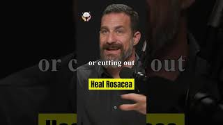 Neuroscientist: "The truth about rosacea" #andrewhuberman #rosacea #rosaceatreatment #food  #shorts