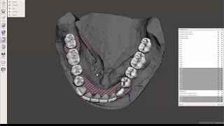 Full Arch Digital Dental Wax-Up in MeshMixer