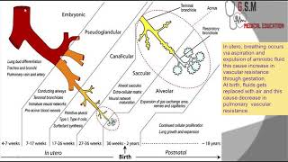 10-congenital lung malformation