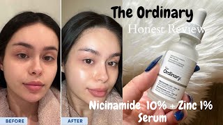 The Ordinary Niacinaminde 10% + Zinc 1% Serum |How to Use|Do,s and Don't