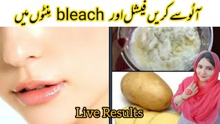 Potato Face Pack| For Glowing Skin, Pigmentation, Acne Scars, Clear Skin| Beesan face pack |