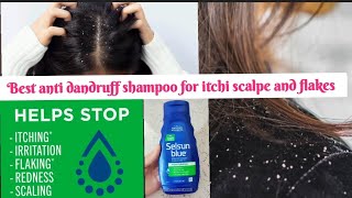 best Anti dandruff shampoo for itchi scalpe and flakes #selsunshampoo #antidandraff