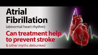 Atrial Fibrillation - Can treatment help to prevent stroke & other myths debunked