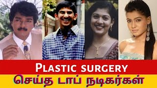 Plastic Surgery Done by Famous Celebrities