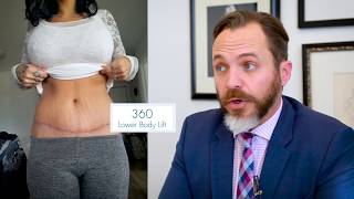 Dr Castañeda -  Crystie's after Weight Loss Procedures