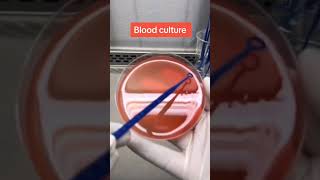 Blood culture and sensitivity test #microbiology#microbiologist #laboratory  #phd #microbiologylab