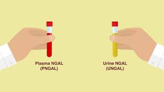 Neutrophil gelatinase-associated lipocalin predicts kidney injury (Ann Lab Med)