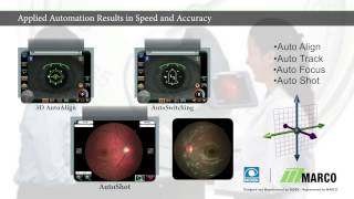 The Marco AFC-330 Retinal Camera:  A New Dimension to Clinical Efficiency