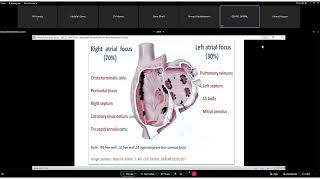 Atrial Tachycardia   Dr  Gehad Gamal