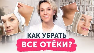 Как убрать ВСЕ отёки? 6 видов отёков лица и борьба с ними