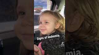 Signs of leukemia in my toddler