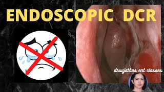 155.Endoscopic DCR surgery  #DCR surgical steps #surgeryeducation #eyesurgery #endoscopicsurgery