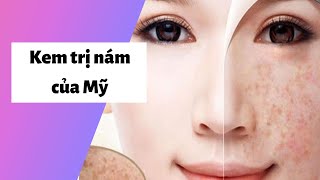 Review kem trị nám của mỹ có tốt không? Giá bao nhiêu tiền? Mua ở đâu