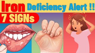 Symptoms Your Body Is Begging For IRON! | Iron Deficiency Symptoms