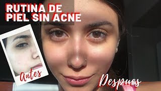 Rutina De Piel Con Acne | Piel Grasa