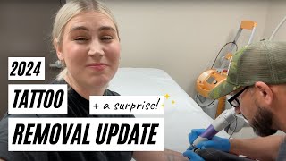 Laser Tattoo Removal Update! See My Appointment + a Surprise