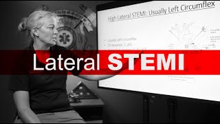 Lateral STEMI