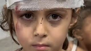 Children Starving in Gaza - A Call to Action #warzone #usa #song