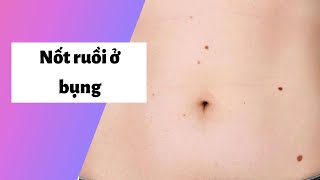 Xem bói Nốt ruồi ở bụng bên Trái, Phải Nam Nữ có ý nghĩa gì? Vận mệnh?