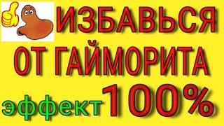 Как вылечить гайморит.  Лечение гайморита и избавление от него наверняка