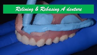 INBDE-Dental decks- Relining & Rebasing A Denture-Prosthodontics