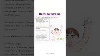 Quick Way to remember Signs & Symptoms of down Syndrome ! Mnemonics @Easemedical