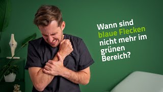 Wie schlimm sind blaue Flecken?