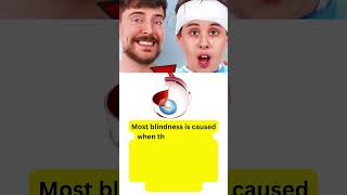 How Mr. Beast Cured Blindness 😱|1000 Blind people see