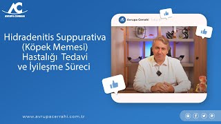 Hidradenitis Suppurativa (Köpek Memesi) Hastalığı  Tedavi ve İyileşme Süreci |Avrupa Cerrahi