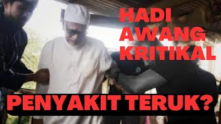 HADI AWANG KRITIKAL