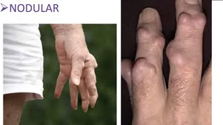 Rheumatoid Hand and Wrist for the FRCSOrth