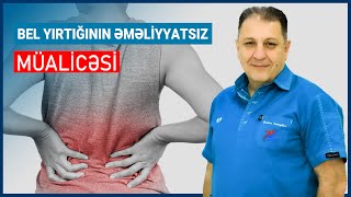 Bel yırtığının əməliyyatsız müalicəsi |  Alqoloq, ağrı həkimi Dr. Zaur İsmayılov